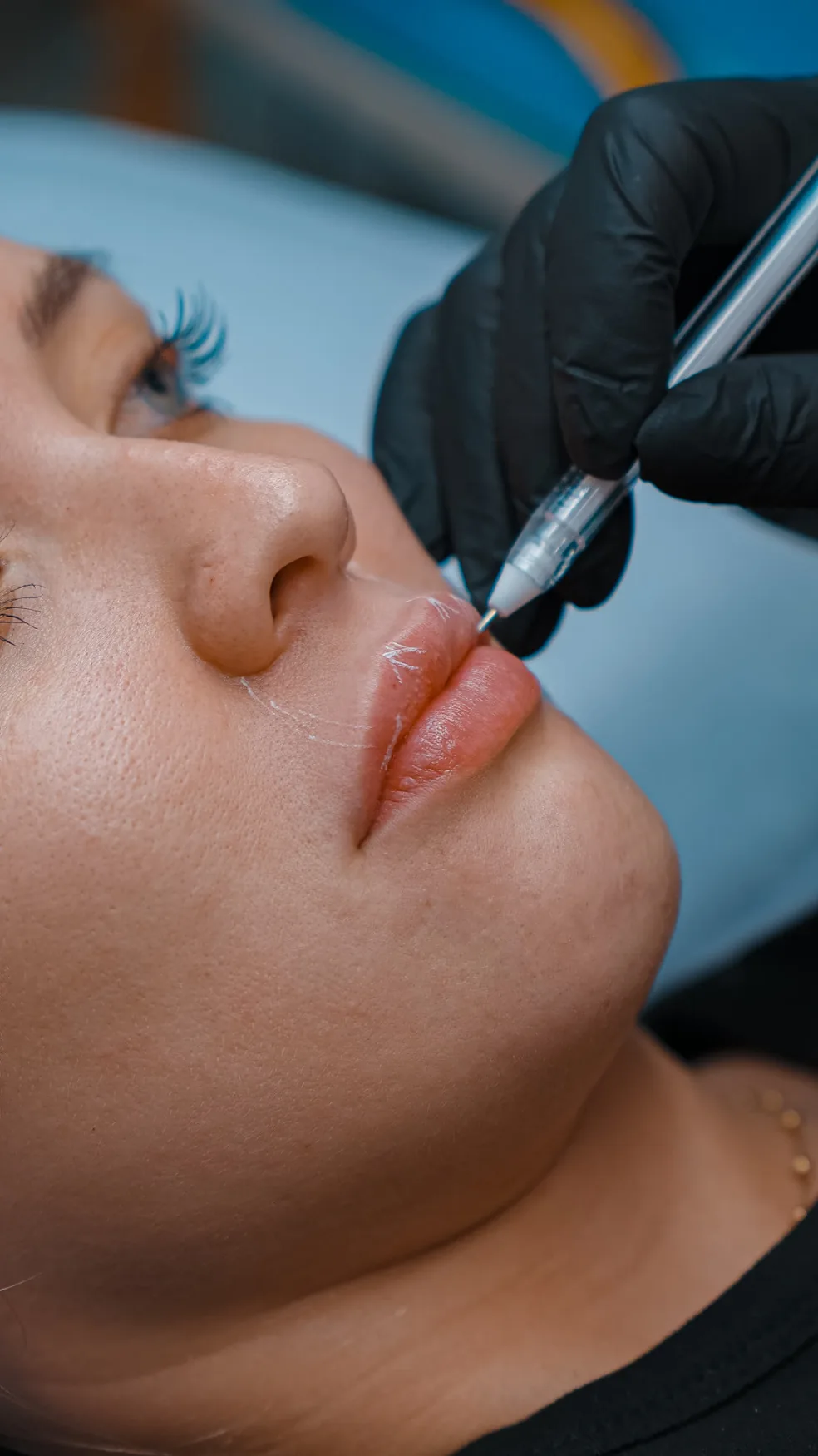 Procedimentos Faciais