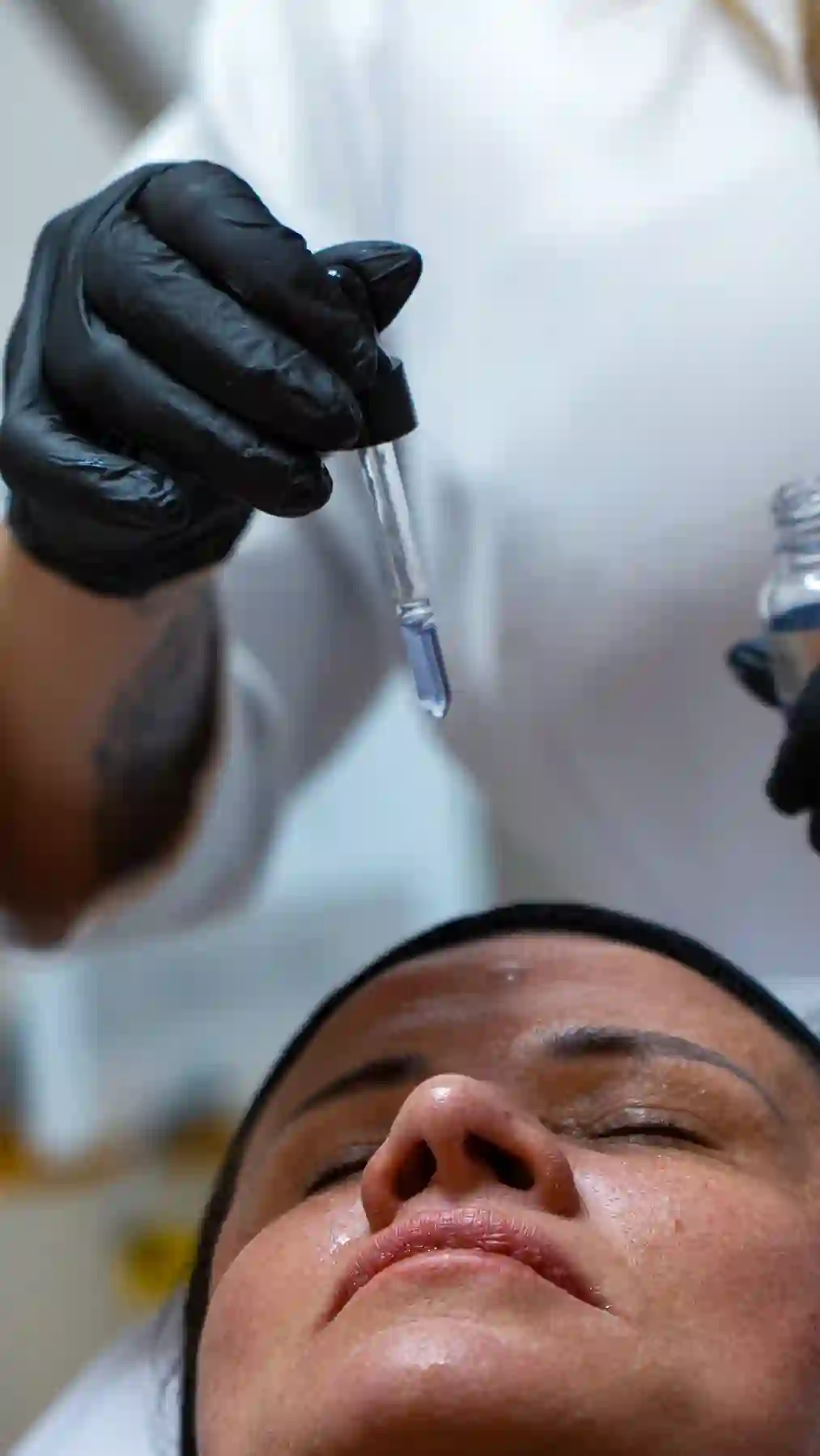 Meso Botox — Dra. Glauce Gonçalves