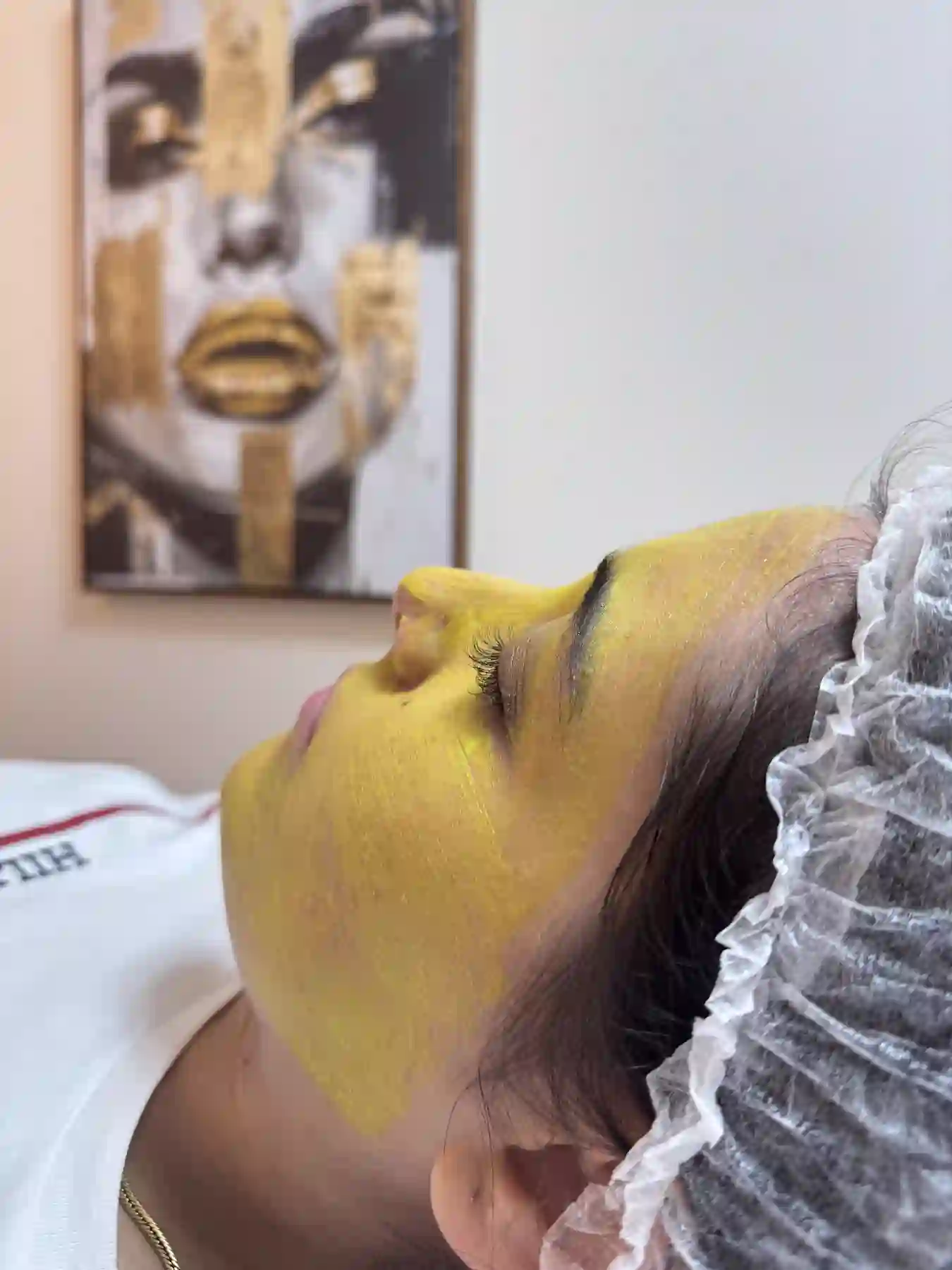 Peelings faciais clareadores e rejuvenescedores — Dra. Glauce Gonçalves