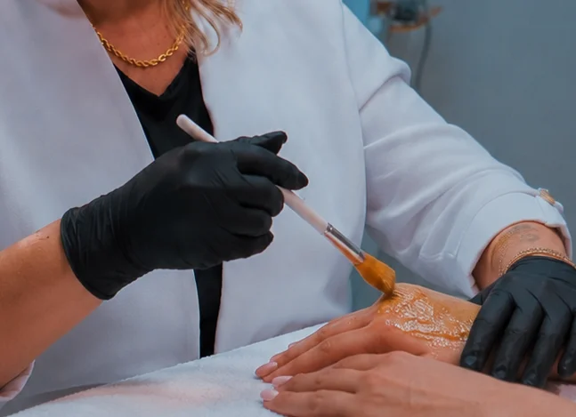 Peeling nas mãos — Dra. Glauce Gonçalves