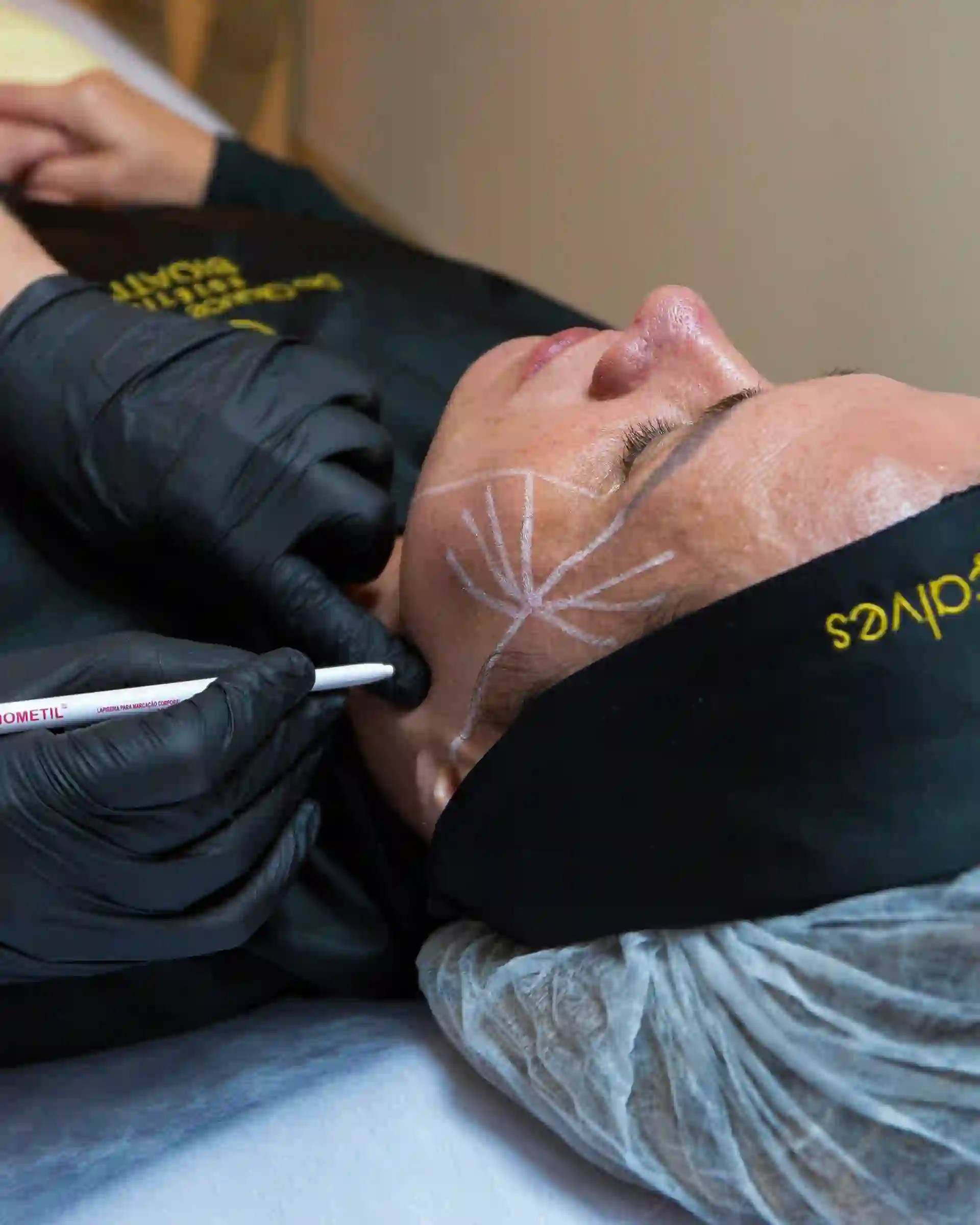 Dra. Glauce Gonçalves aplicando a metodologia Estética Bioativa